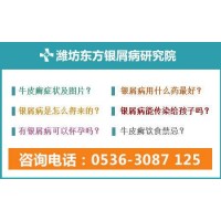 濰坊看銀屑病專業(yè)的公立醫(yī)院